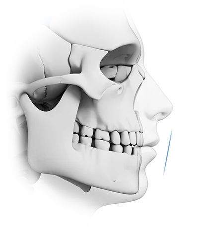 Human skull anatomy for plastic surgery where natural. 345 Plastic Surgery.