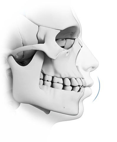 345 Plastic Surgery skull showing natural jawline. Plastic surgery for a natural look.