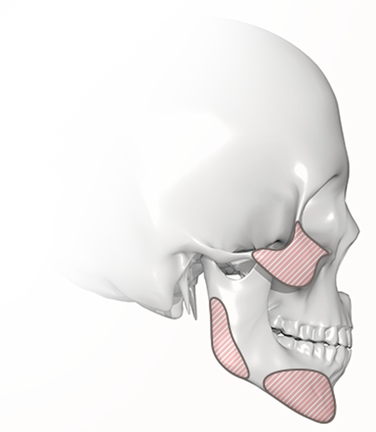 345 Plastic Surgery showing facial bone structure where natural plastic surgery can enhance features