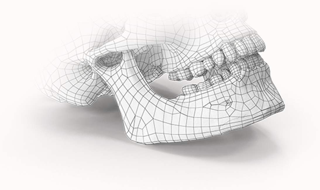 3D wireframe of skull for plastic surgery. 345 Plastic Surgery where natural.