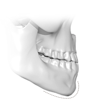345 Plastic Surgery where natural jaw bone model for plastic surgery consultation.
