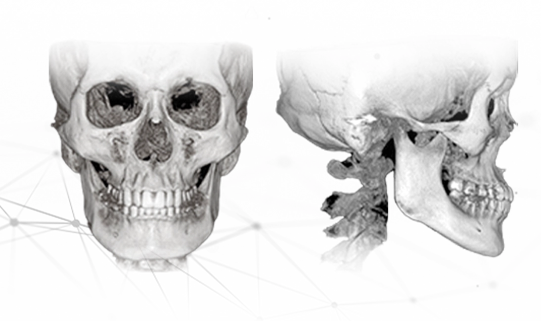 3D skull X-ray for plastic surgery where natural results are desired. 345 Plastic Surgery.