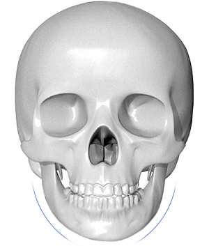 Skull with blue line indicating chin for 345 plastic surgery where natural.