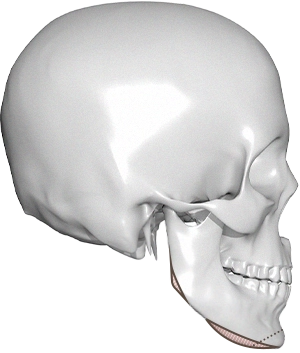 345 Plastic Surgery where natural. Skull side view showing chin augmentation plastic surgery procedure.