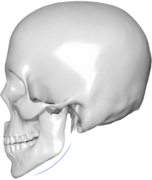 345 Plastic surgery where natural skull anatomy. Plastic surgery for natural look.