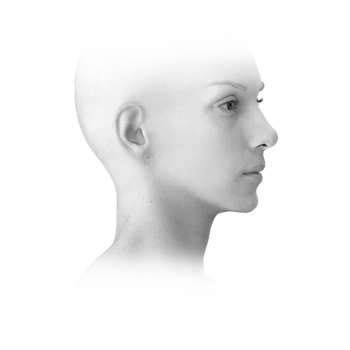 Woman's face profile for 345 plastic surgery where natural results are the goal.