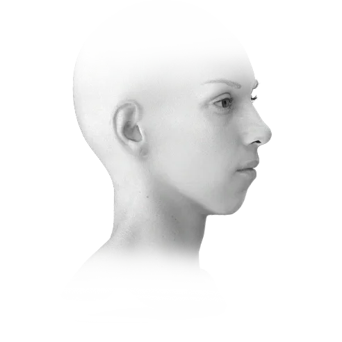 Woman's face profile for 345 plastic surgery where natural results are the goal.