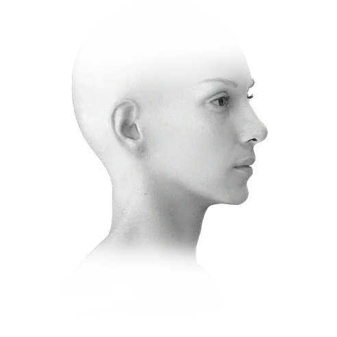 Side profile of woman for 345 plastic surgery; natural results.