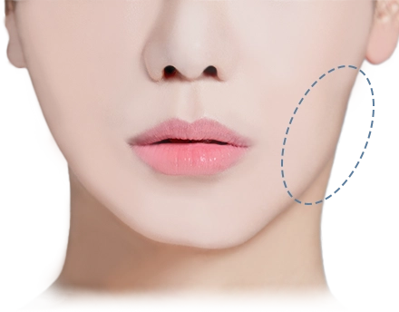 Woman's face showing area for 345 plastic surgery where natural.