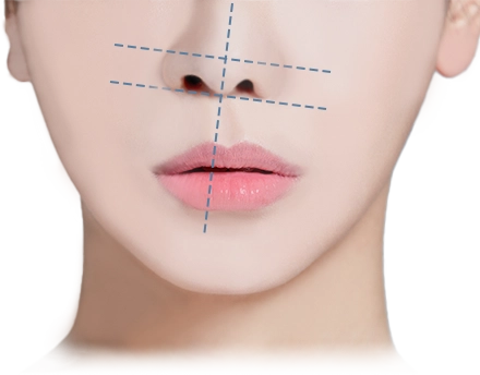 Face with dotted lines for 345 Plastic Surgery where natural look is key.