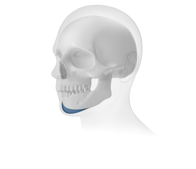 345 Plastic Surgery chin implant for natural facial contouring. Skull shows chin augmentation procedure.