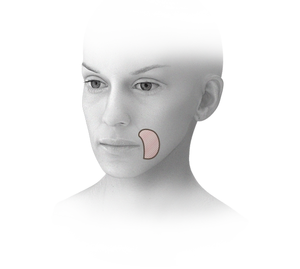 Illustration of face showing area for 345 plastic surgery where natural