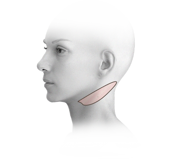 345 Plastic Surgery where natural platysma muscle diagram for neck lift plastic surgery.
