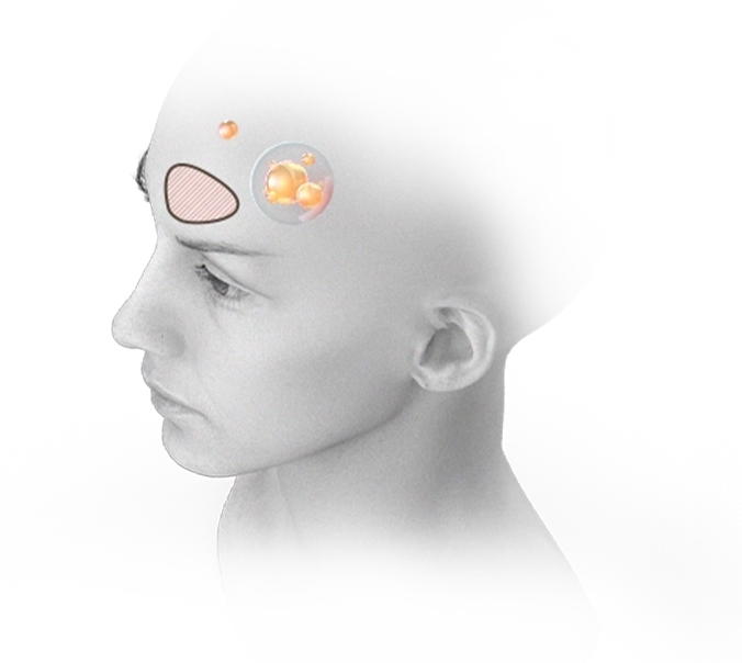 345 Plastic surgery illustration showing natural results on a womans face