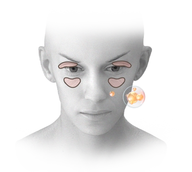 Woman's face showing areas for 345 plastic surgery where natural