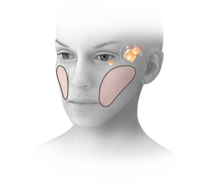 Facial plastic surgery diagram showing natural 345 plastic surgery areas.