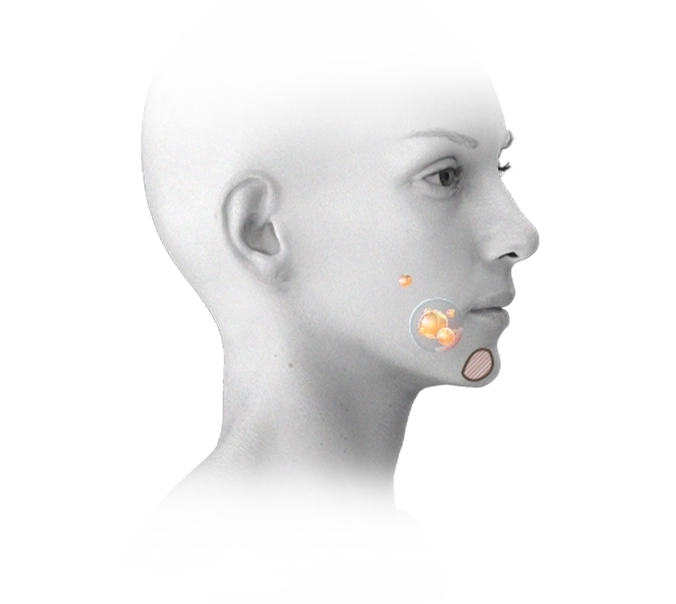 Female face graphic for 345 plastic surgery where natural results are desired.