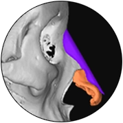 345 Plastic Surgery where natural: Ear reconstruction with colored implants.