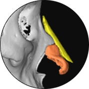 345 Plastic Surgery: Natural nose plastic surgery 3D rendering of nasal structure.