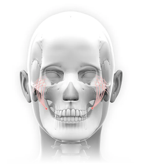 Human skull anatomy with red lines for plastic surgery where natural 345