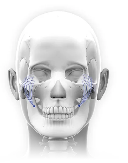 Human skull with blue grid for 345 plastic surgery where natural.