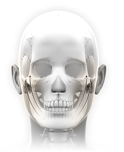 Skull diagram showing jawline 345 plastic surgery where natural.