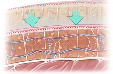 Anatomy of skin layers with arrows for 345 Plastic Surgery where natural results