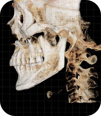345 Plastic Surgery where natural skull and spine CT scan. Medical imaging for plastic surgery.