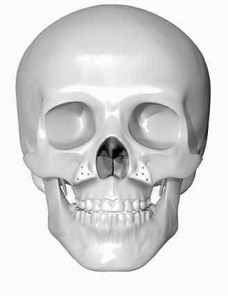 345 Plastic Surgery skull image where natural facial bone structure is visible