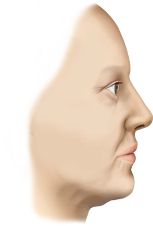 Female face profile for 345 Plastic Surgery where natural results are desired.