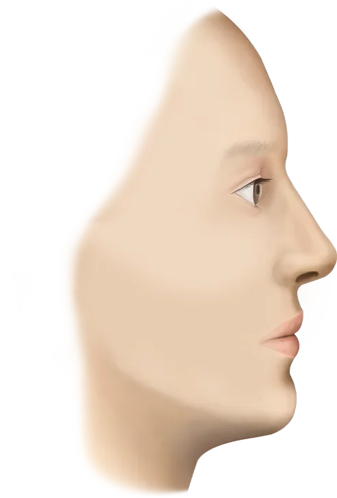 Side profile of face for 345 plastic surgery where natural results are achieved.