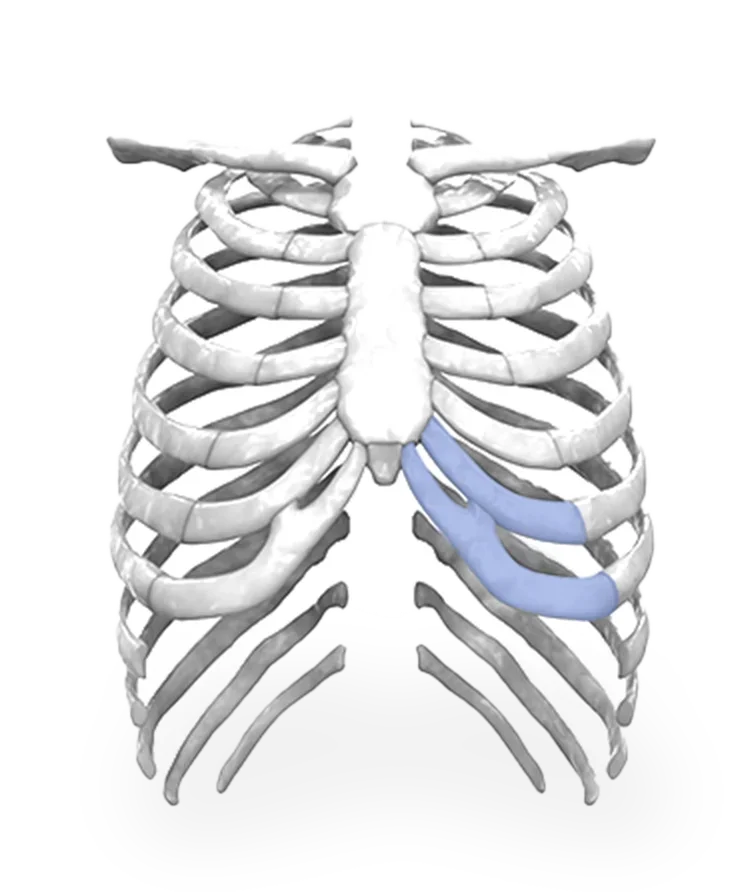 Rib cage anatomy for 345 Plastic Surgery where natural breast augmentation. Ribs highlighted in blue.