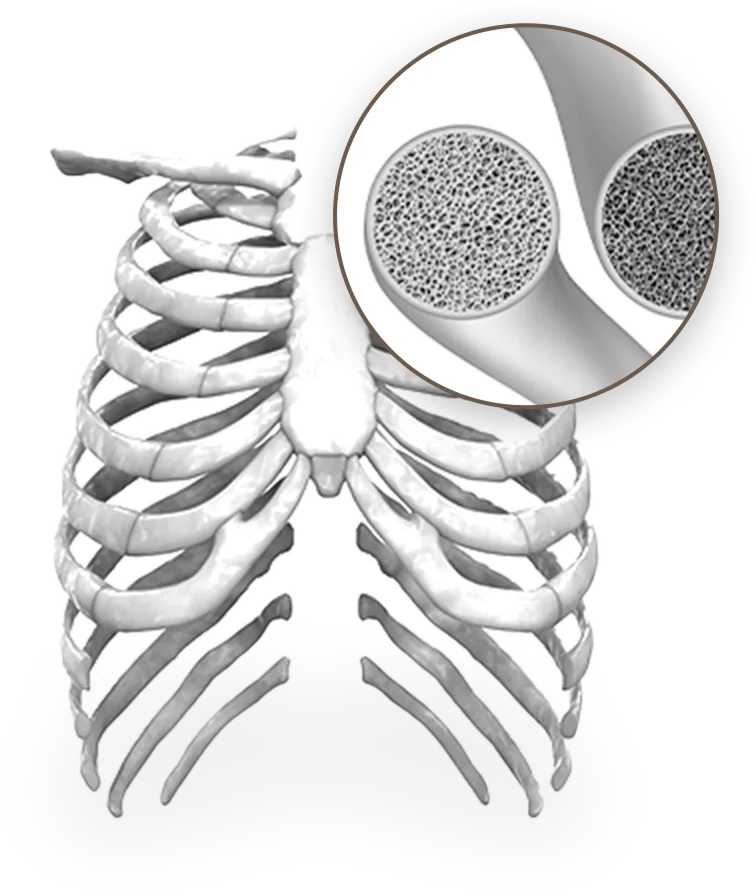 Rib cage anatomy with bone close up for 345 plastic surgery where natural results.
