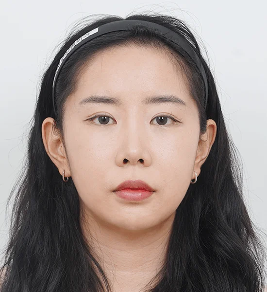Asian woman's face before 345 plastic surgery where natural look is desired.