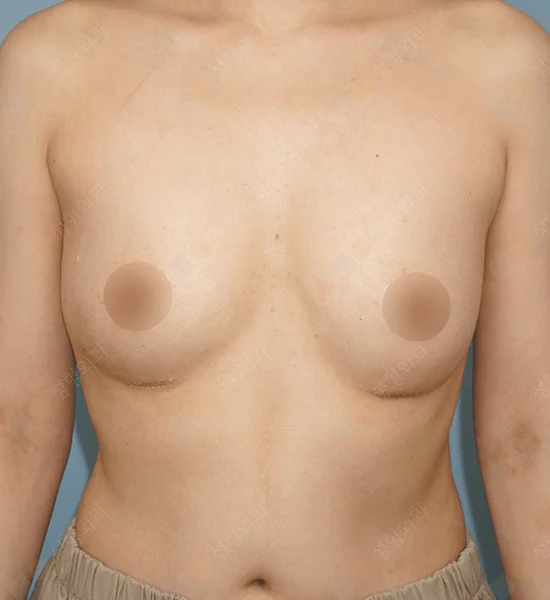 345 Plastic Surgery where natural breast augmentation results. Natural looking plastic surgery.