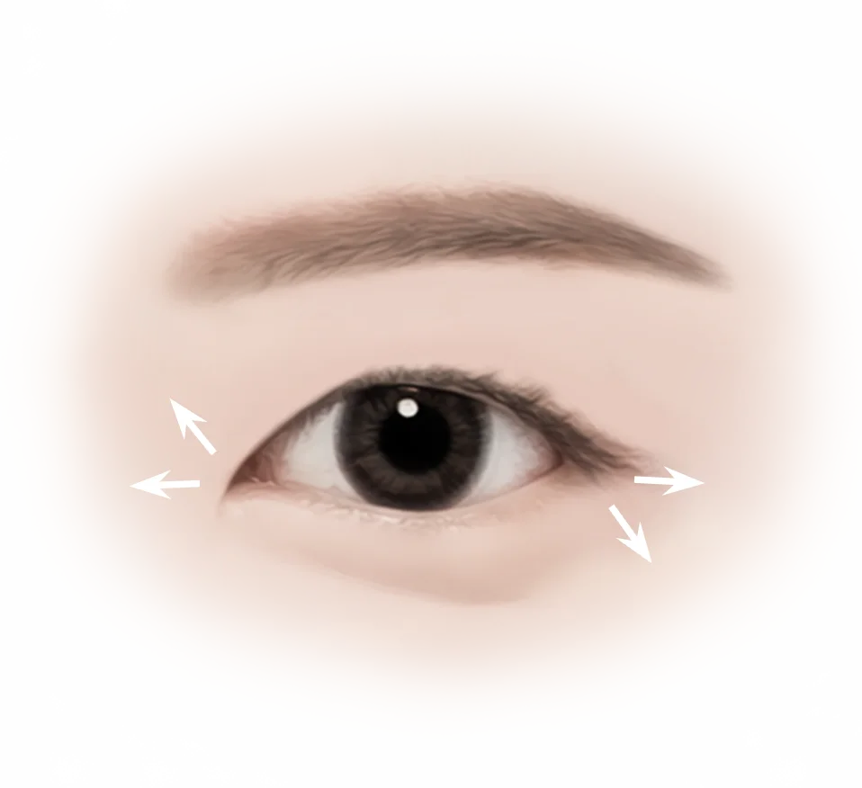 Eye with arrows indicating plastic surgery area for natural 345 plastic surgery results.