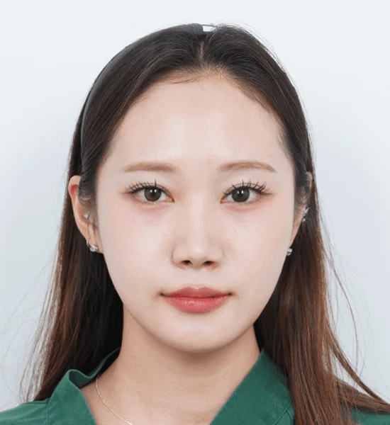 Asian woman portrait, 345 plastic surgery where natural results are desired.