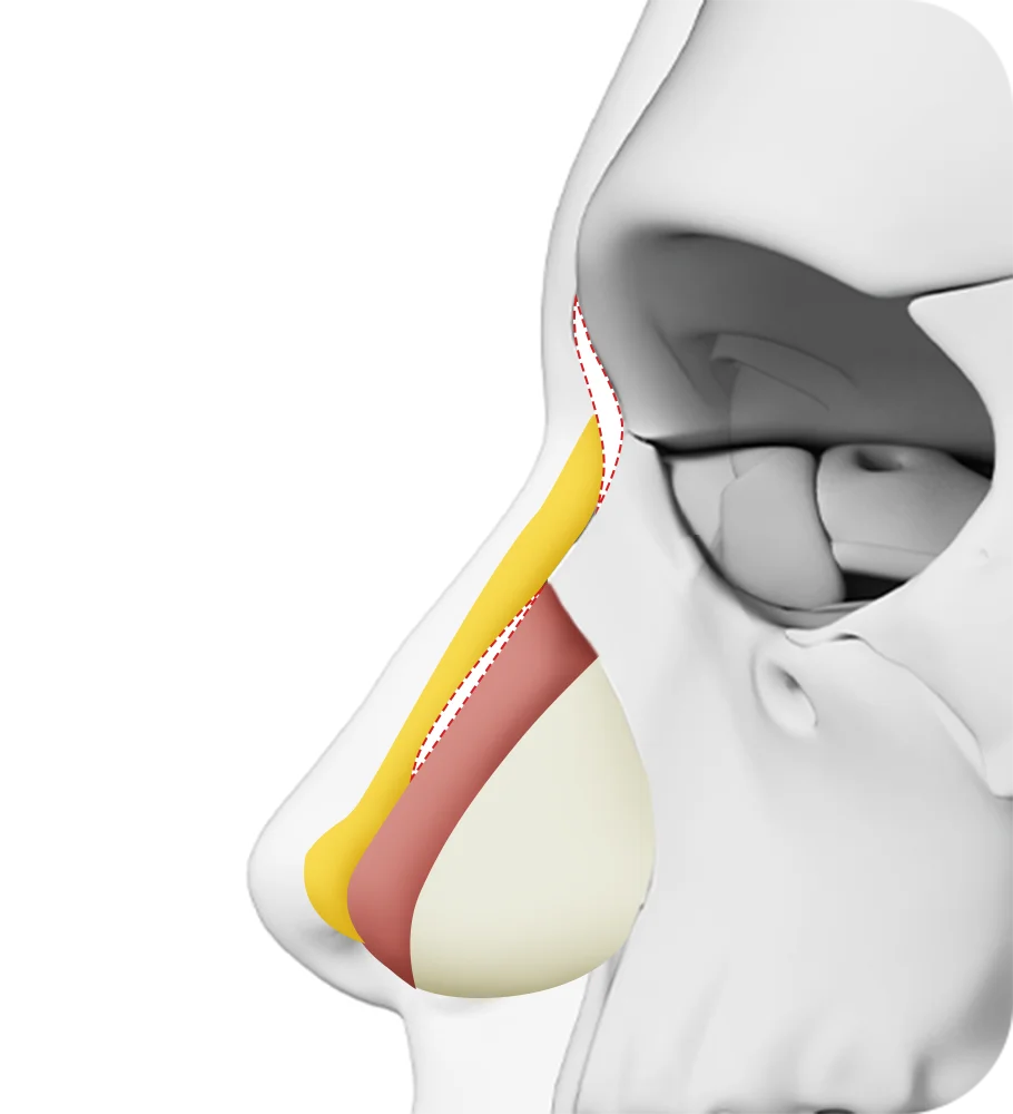 345 Plastic Surgery diagram shows natural nose structure for plastic surgery.