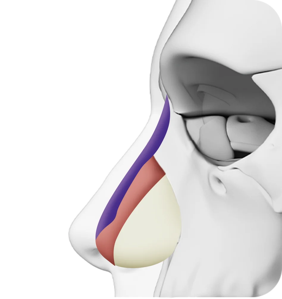 345 Plastic Surgery where natural nose anatomy diagram for rhinoplasty showing cartilage and bone.