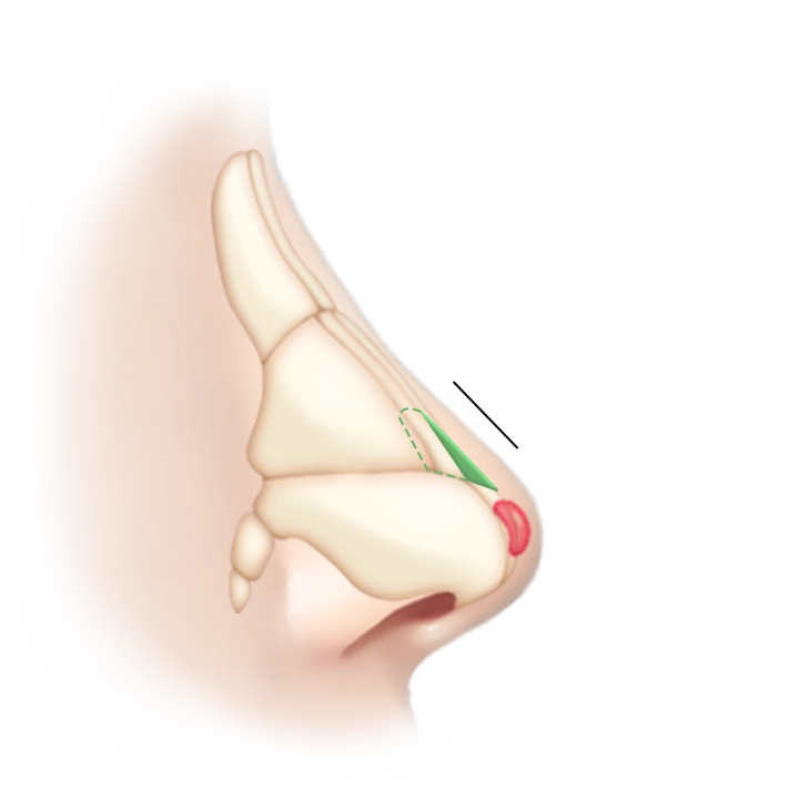Side view of nasal anatomy illustration