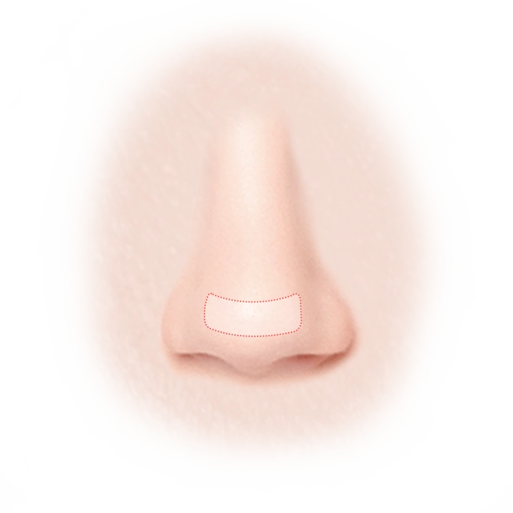 Nose with dotted line for 345 plastic surgery where natural rhinoplasty.