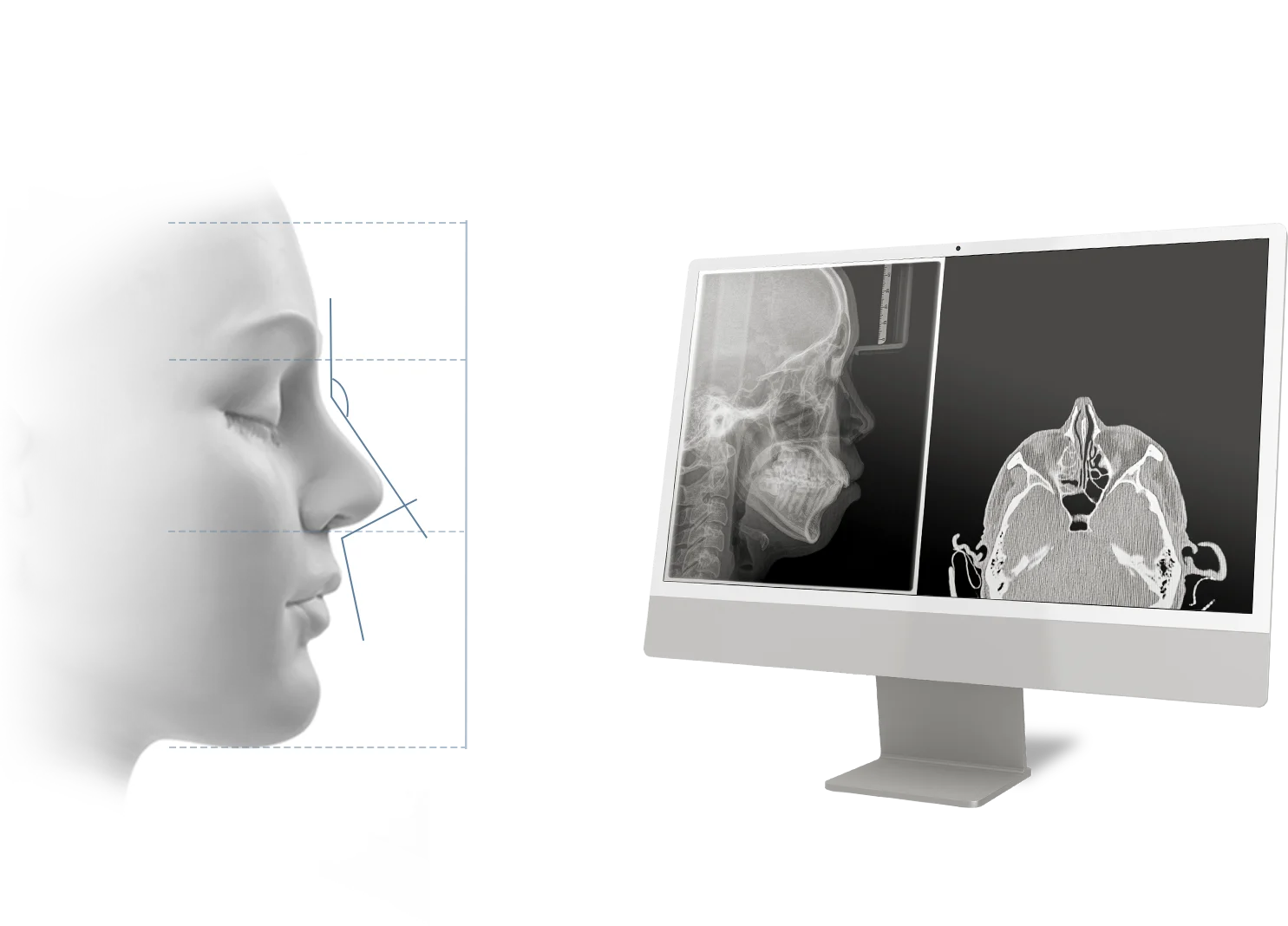 345 Plastic Surgery, Natural Rhinoplasty. Face analysis with X-ray for nose job.